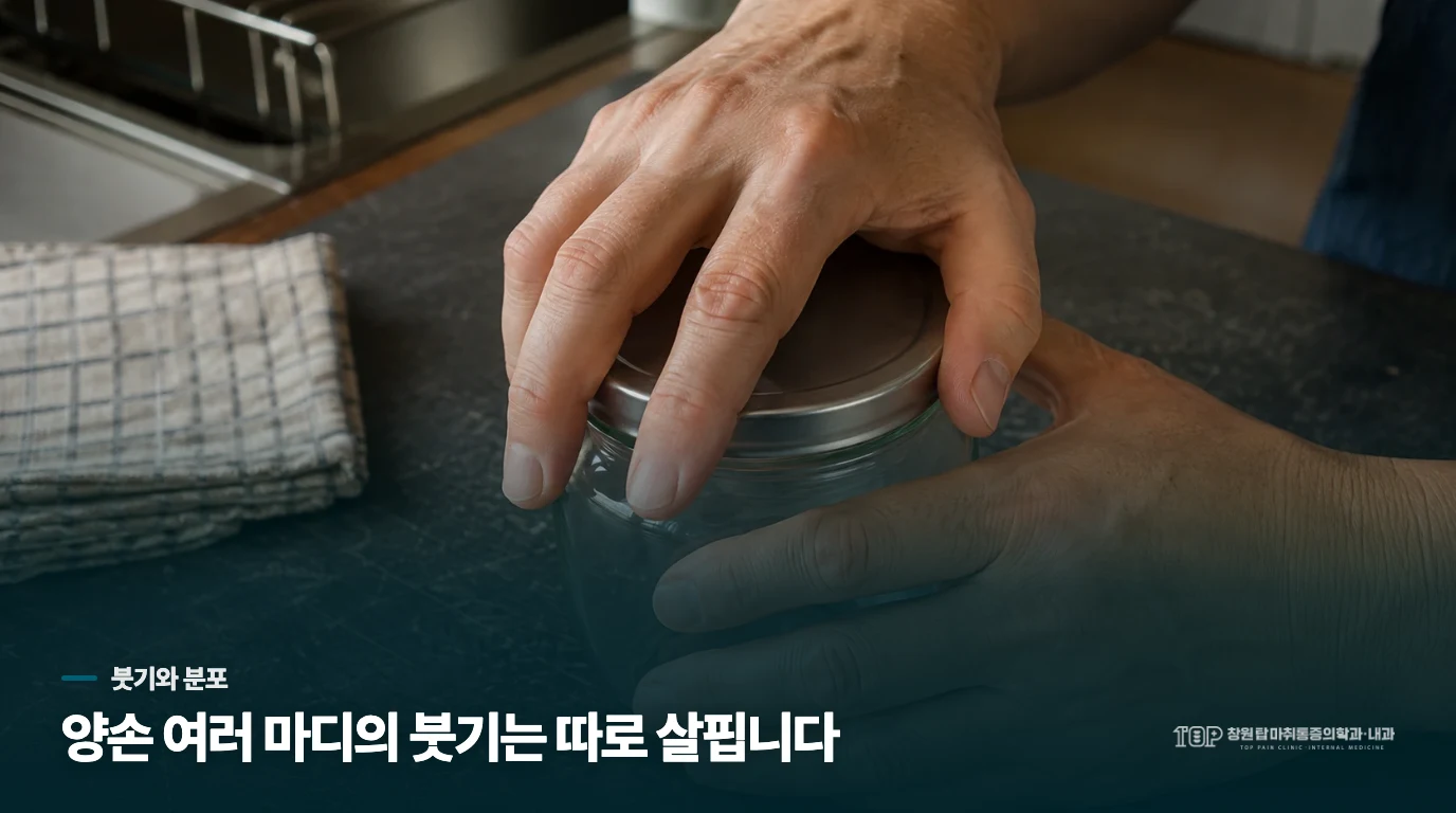 한 마디의 사용 통증과 양손 여러 관절의 붓기는 다르게 봅니다