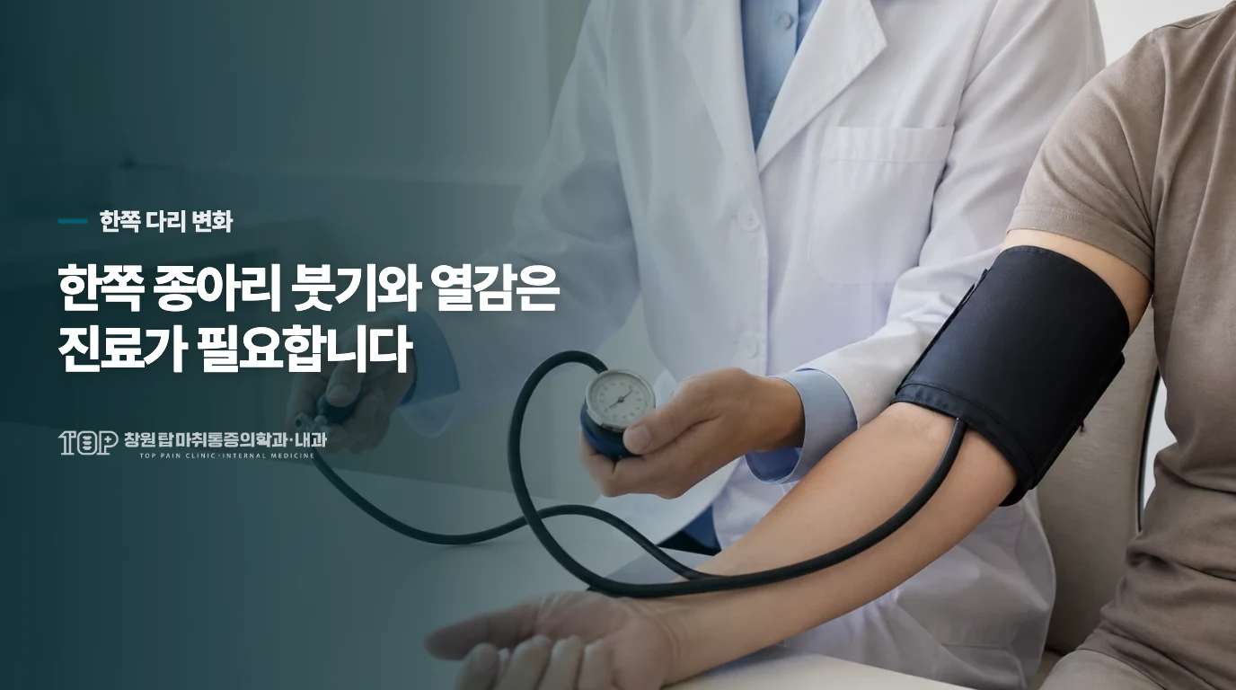 한쪽 종아리 붓기와 열감은 다르게 봅니다
