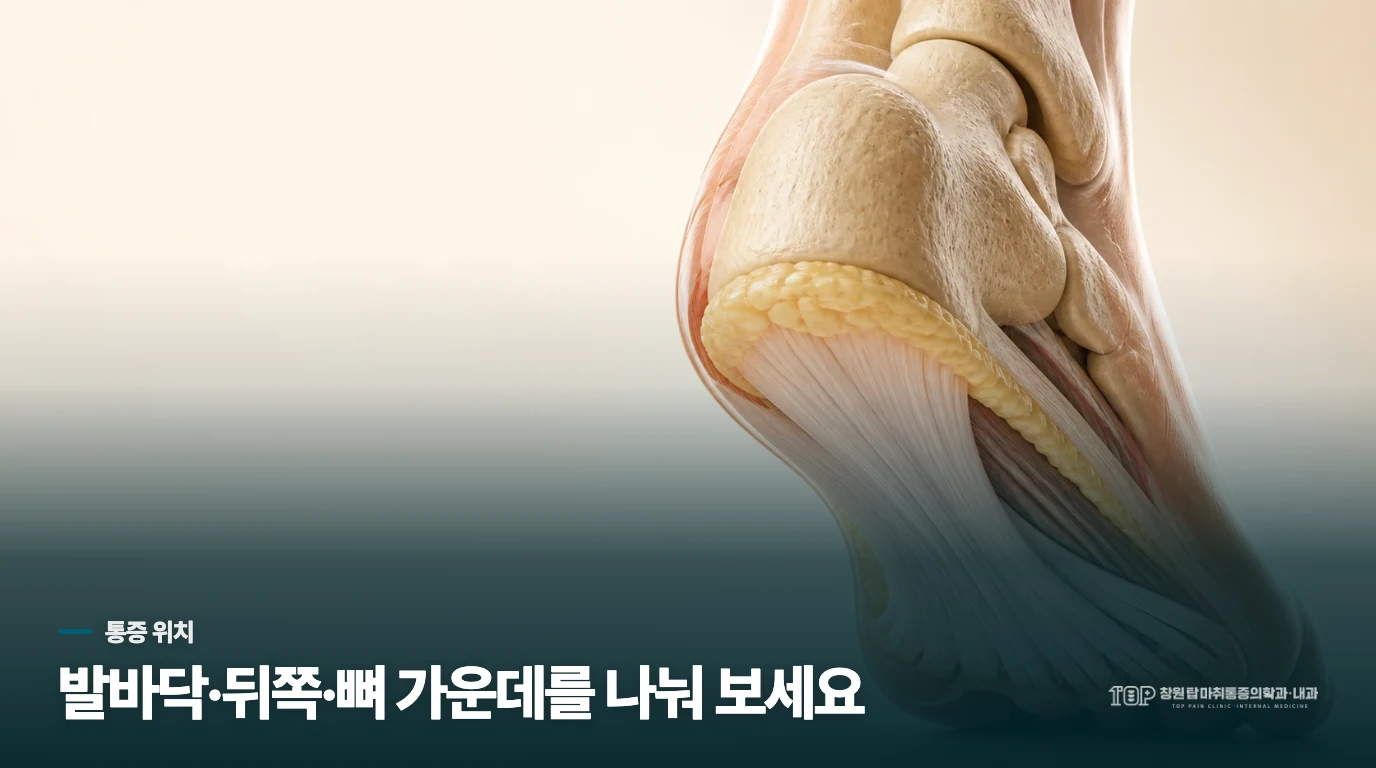 신발을 바꿔도 발뒤꿈치가 아픈 이유는 무엇일까요?