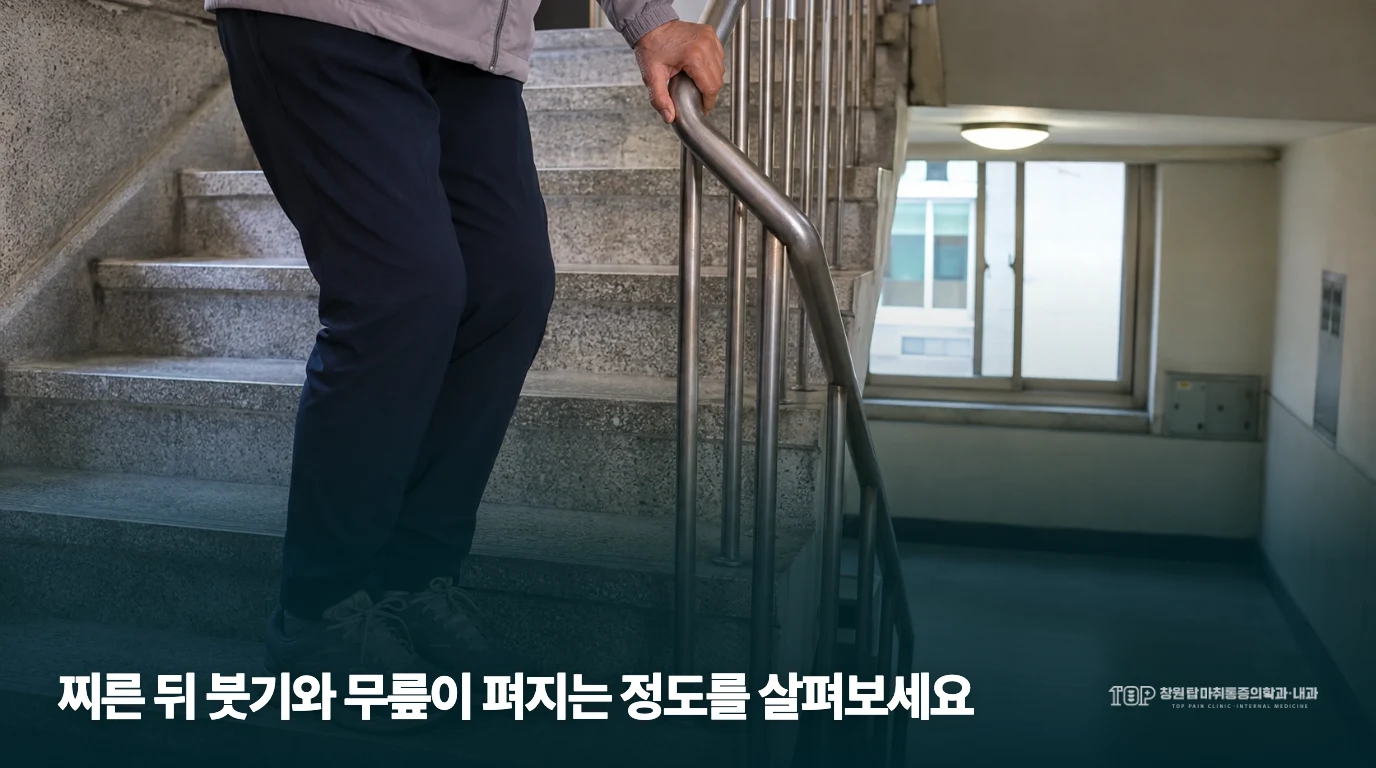 계단에서 난간을 잡고 서 있는 하체 생활 장면