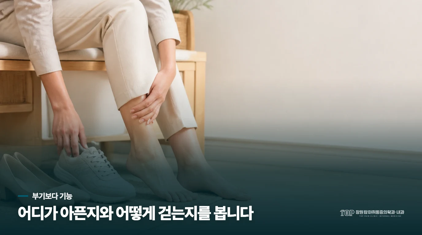 부기의 자리와 발목 움직임을 나눠 보세요