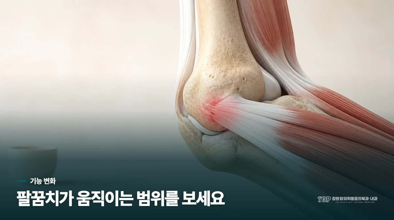 통증의 세기보다 팔꿈치 움직임을 살펴보세요