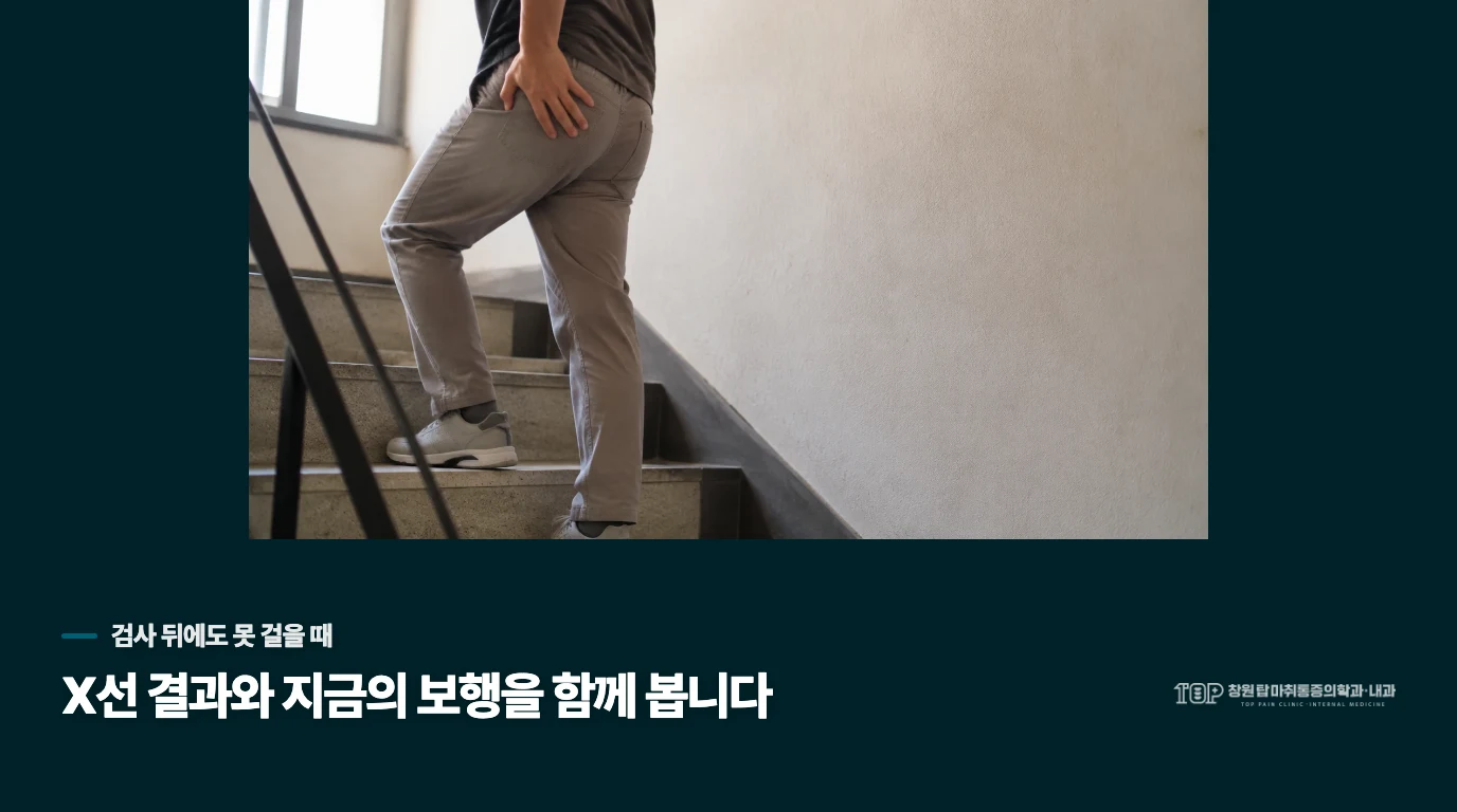 X선이 정상이었는데도 못 걷는다면