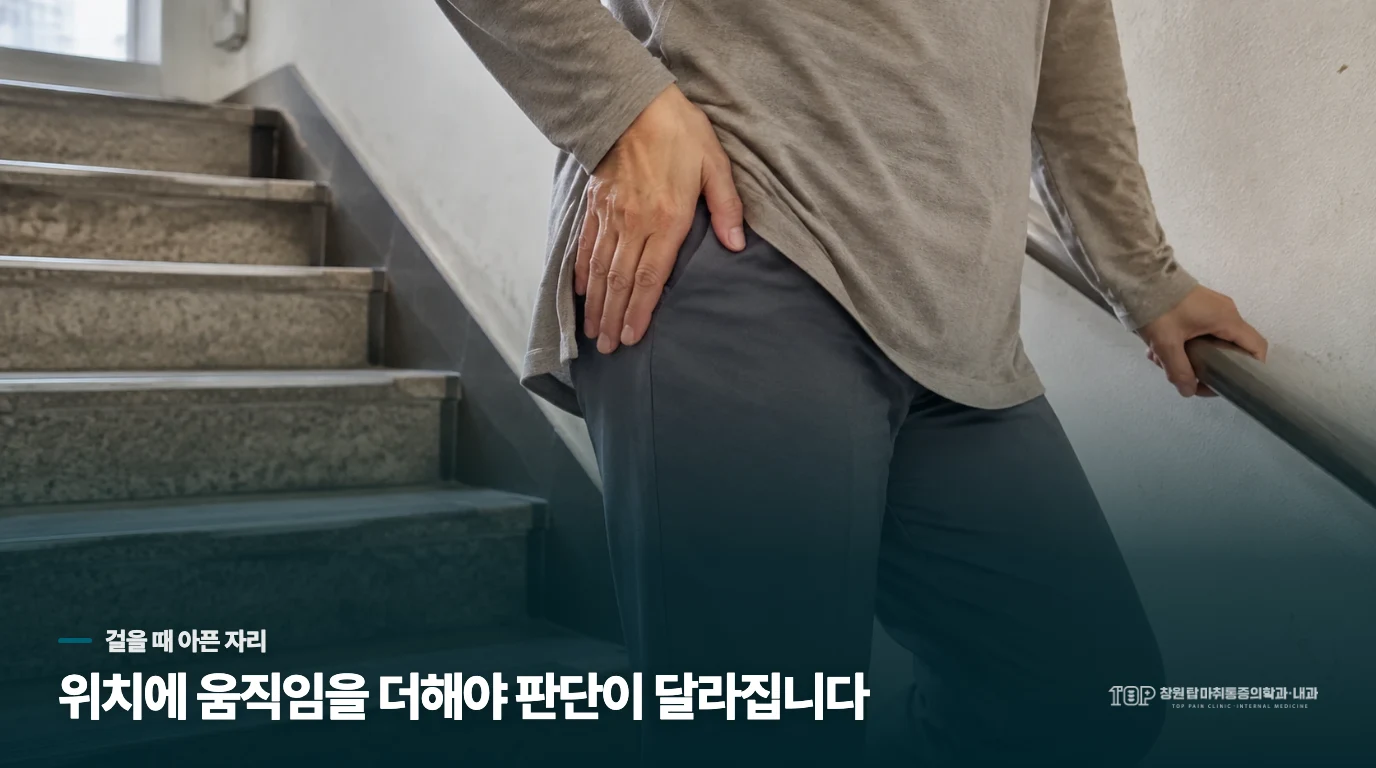 걸을 때는 바깥쪽, 계단에서는 사타구니까지 아프다면