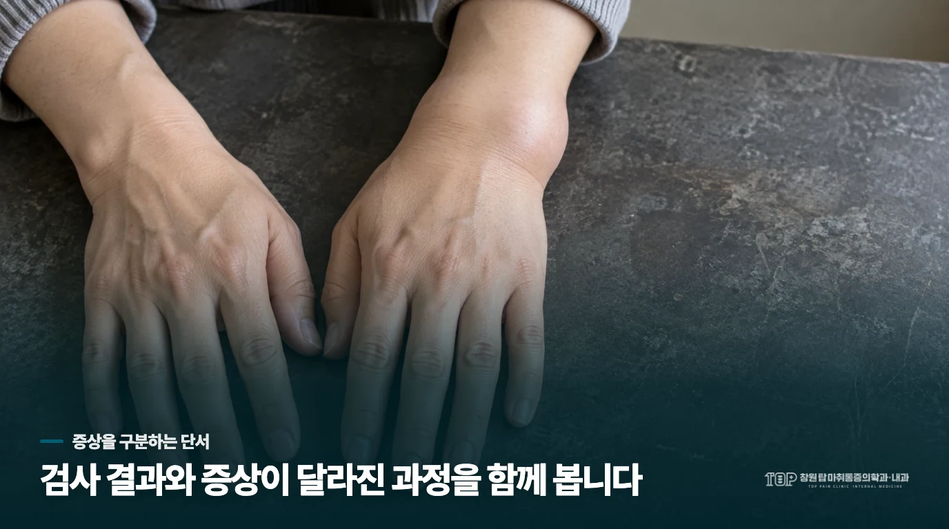 붓기와 악력 저하는 기다림을 줄입니다